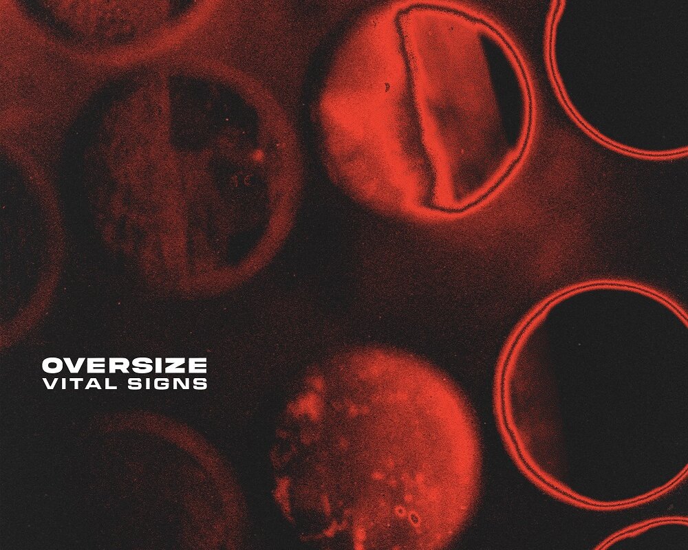 New UK Alt-Shoegaze Band Oversize  Release New Single “Vacant”; Debut LP “Vital Signs” Released 28th February 2025 Via Sharptone
