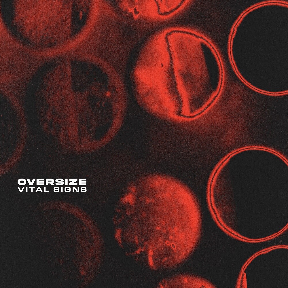 New UK Alt-Shoegaze Band Oversize  Release New Single “Vacant”; Debut LP “Vital Signs” Released 28th February 2025 Via Sharptone